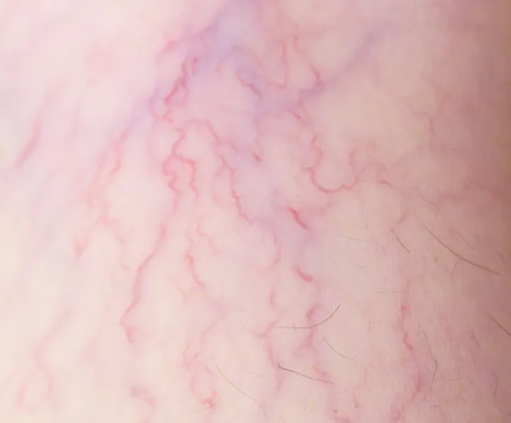skin veins texture